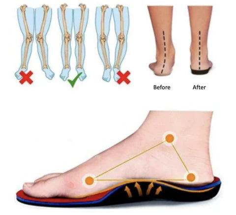 Mia | Baskets orthopédiques confortables